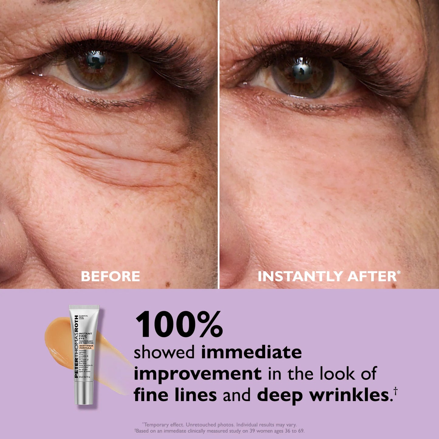 Revive™ Instant Eye Tightener