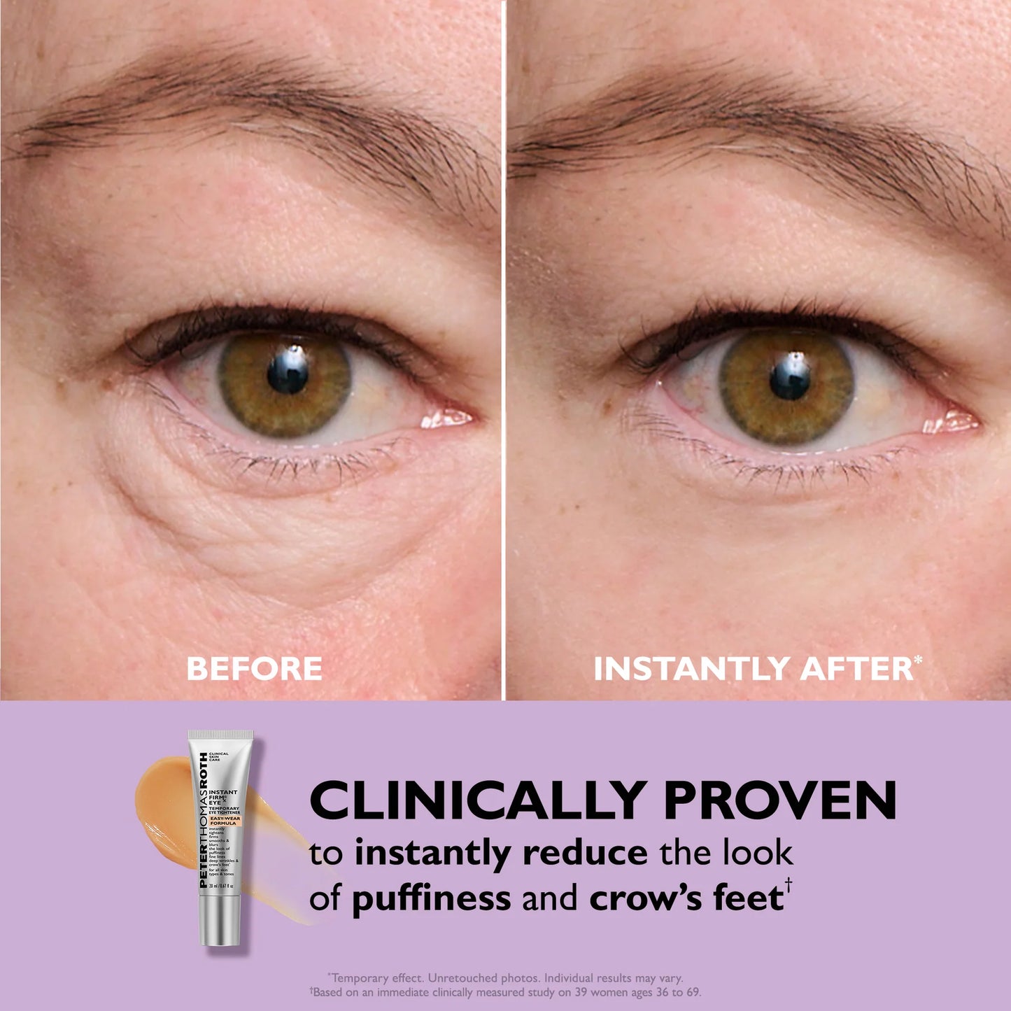 Revive™ Instant Eye Tightener