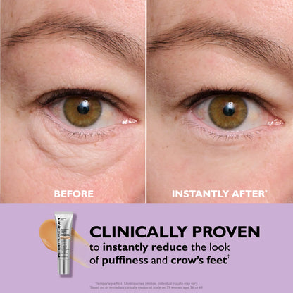 Revive™ Instant Eye Tightener